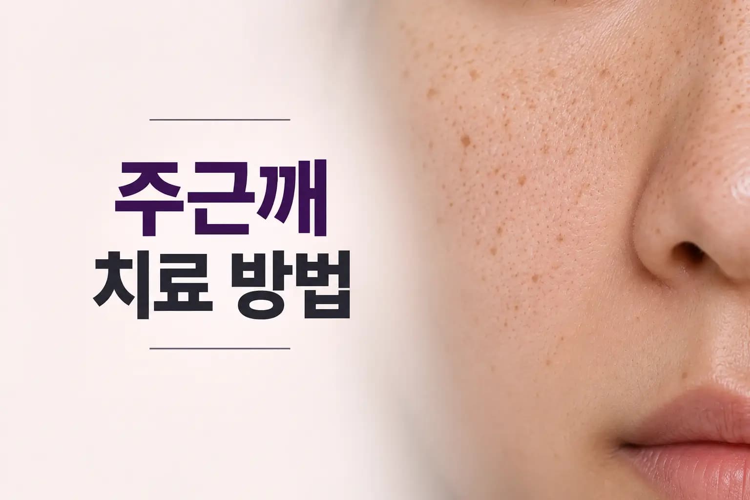 주근깨 레이저 효과와 장비별 선택 기준, 권장 횟수를 알려주는 의료 컨텐츠