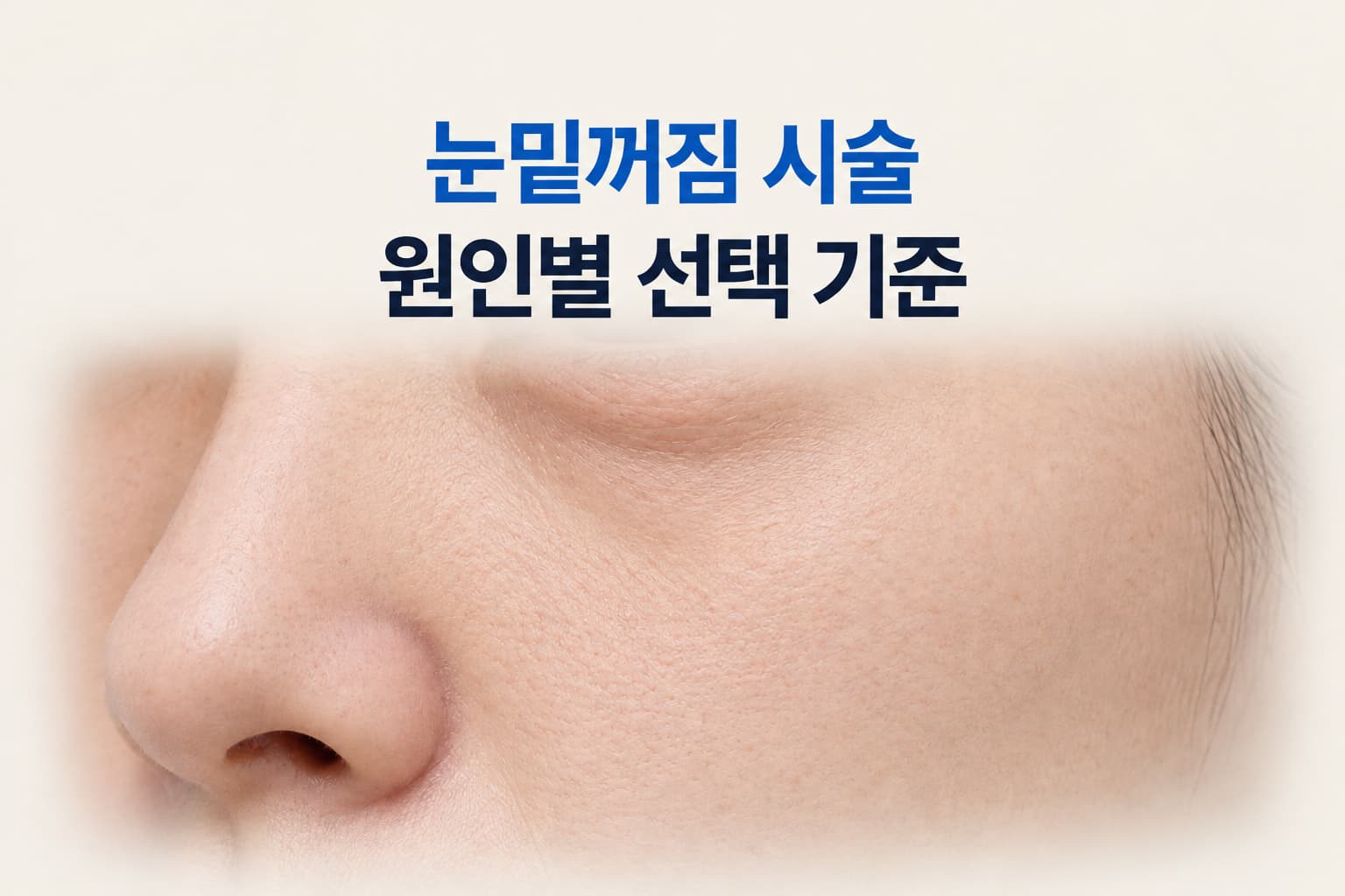눈밑꺼짐 시술의 원인별 선택 기준과 눈물고랑 주변 피부 상태를 보여주는 썸네일