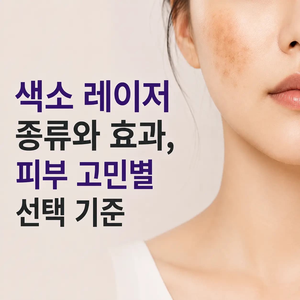 색소 레이저 종류와 효과, 피부 고민별 장비 선택 기준을 안내하는 컨텐츠