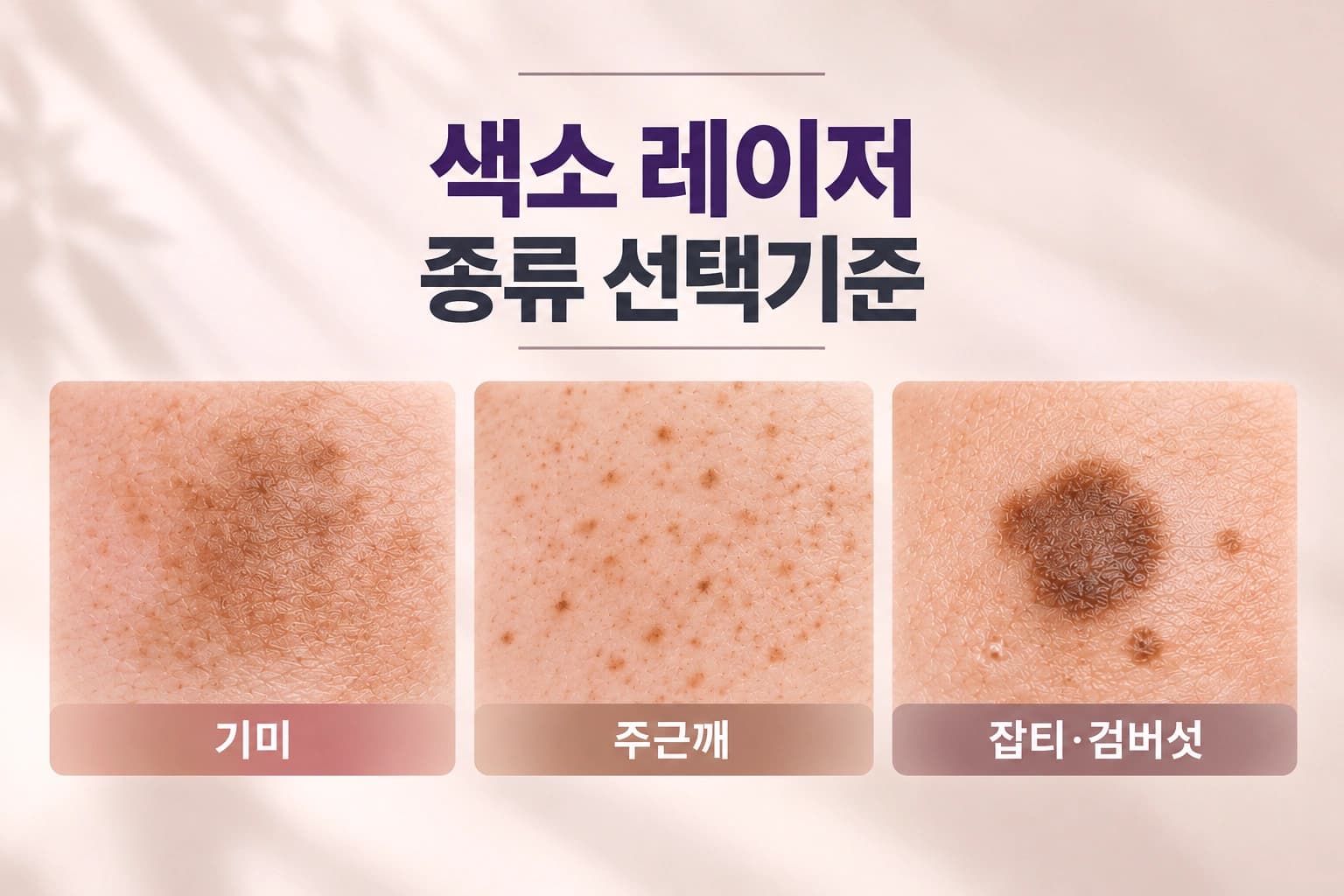 색소 레이저 종류와 효과, 피부 고민별 장비 선택 기준을 안내하는 컨텐츠