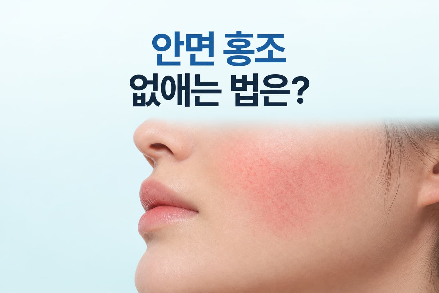 볼 주변의 붉은기와 확장된 혈관을 보여주고 안면홍조 없애는 법을 알려주는 컨텐츠 썸네일